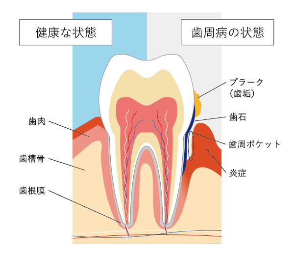 歯周病治療 | 文京区江戸川橋駅1分の歯医者「医療法人社団K＆K 江戸川