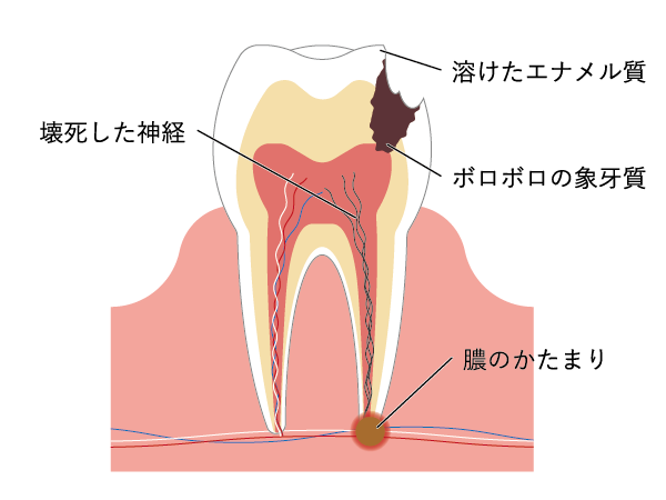 cdd38c245bd3d223b710871dc60dca
