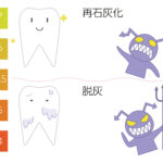 江戸川橋　歯医者　酸蝕症には内因性、外因性の要因がある　江戸川橋菊地歯科医院