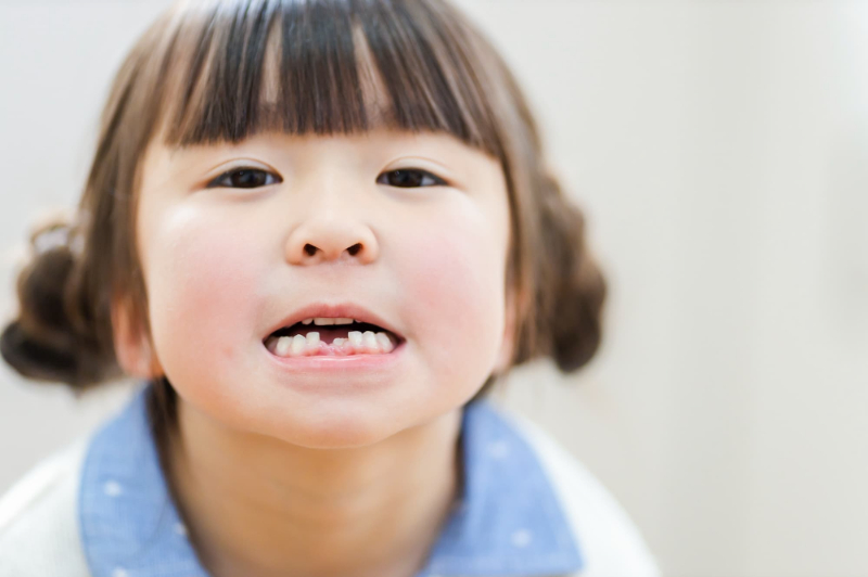 生え変わっている途中の下の前歯を見せる女の子