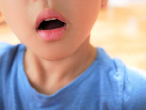 口呼吸をしている男の子の口元