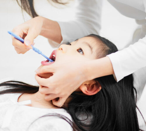 膝の上に頭をのせて仕上げ磨きをしてもらう子ども