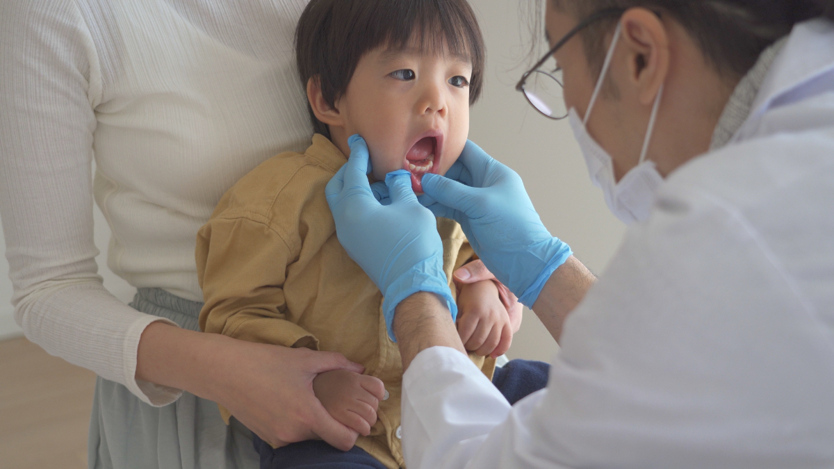 子どもの歯に歯石があるかチェックしている歯科医師