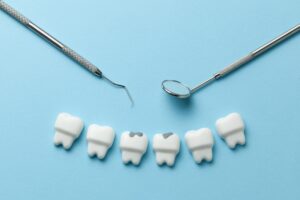 歯と歯の間に潜む虫歯を検診するイメージ